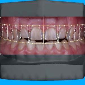 3Dent_04