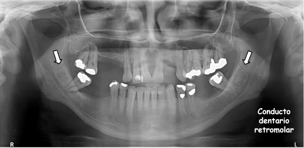 3Dent_05
